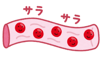 イラスト：動脈硬化