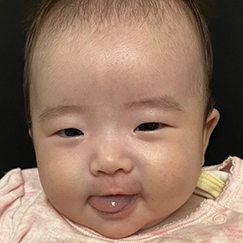 写真:赤ちゃん りん