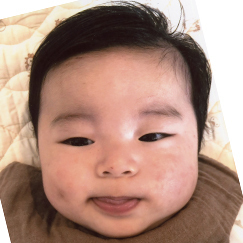 写真:赤ちゃん あお