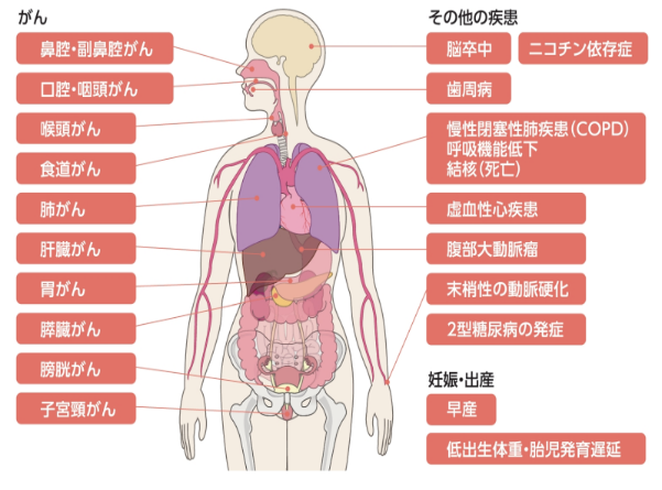 イラスト：がん　その他の疾患　妊娠・出産