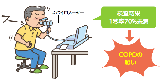 スパイロメーター