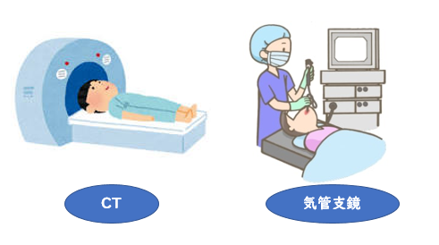 CT　気管支鏡イラスト