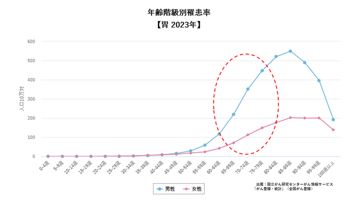 年齢階級別罹患率【胃 2023年】
