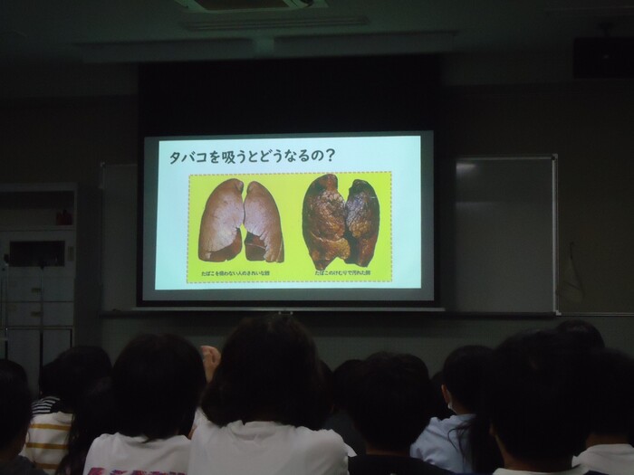 スライド